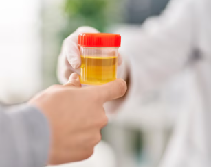 Анализ ДНК в моче для прогнозирования рецидивов рака мочевого пузыря после иммунотерапии