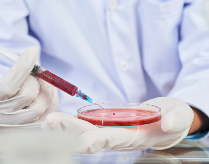 Новый метод ранней диагностики болезни Паркинсона по крови